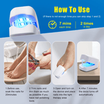 Electric Nail Fungus Laser Treatment Removal