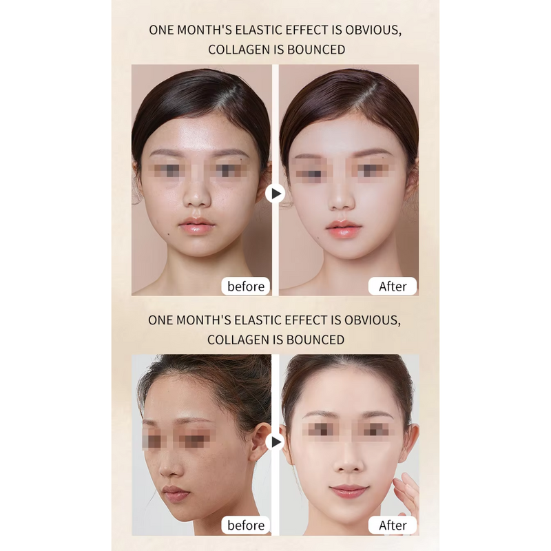 7D NEW Mini Hifu Ultrasonic Face Lifting Massager