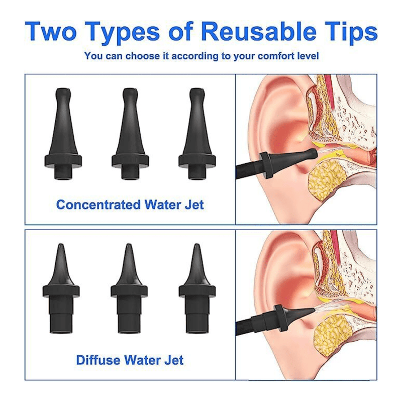 Automatic Electric Irrigation Flushing Ear Wax Removal