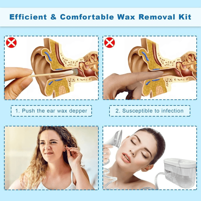 Electric Irrigation System Safety Ear Wax Removal