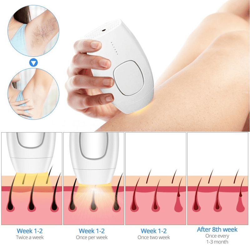 IPL Laser Permanent Hair Removal Handset