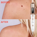 Revita - Moles, Freckles, Skin Tags and Spots Remover