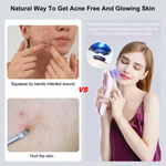 Newest Professional Ozone Plasma Pen