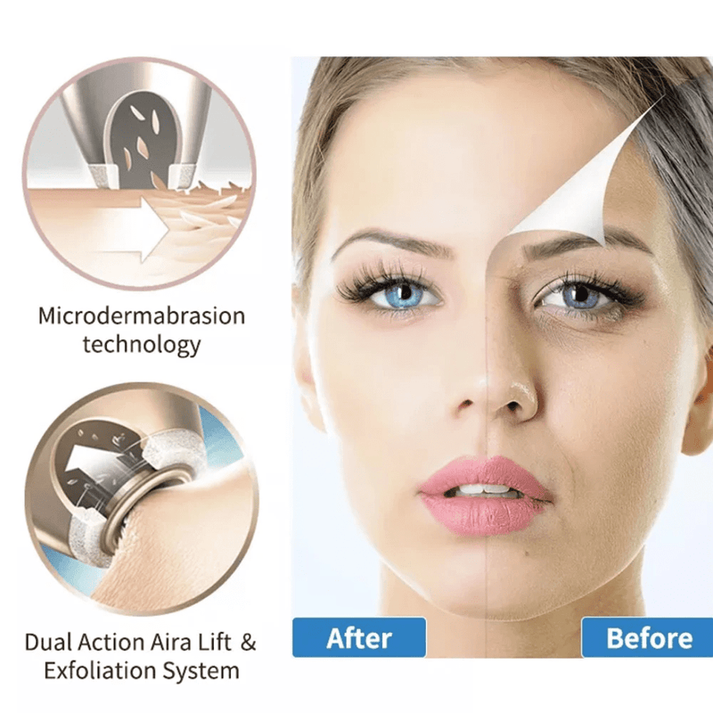 Portable Micro-dermabrasion Facial Beauty Device