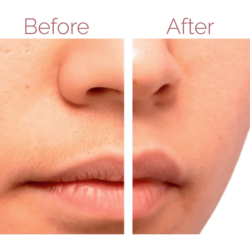 Rechargeable Finishing Touch Women's Painless Hair Remover