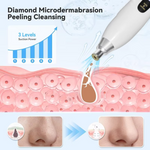 Upgraded Diamond Micro-dermabrasion Vacuum Blackhead Remover