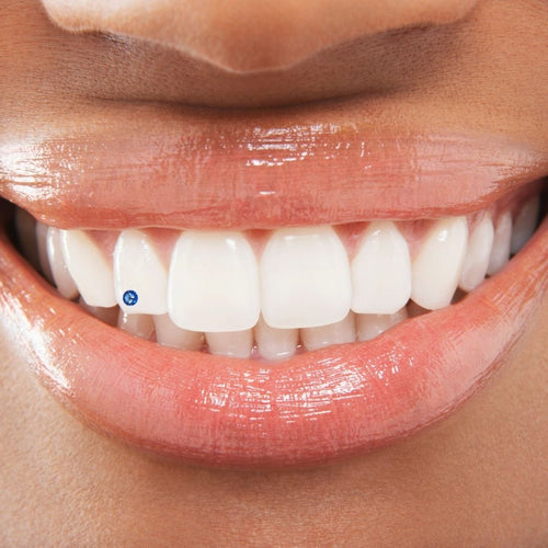 Gemstone Teeth Decoration Glue ââ‚¬â€œ Solidify Tooth Rhinestones UV Light  Hardening - Trendy Smile Jewelââ‚¬â„¢s Setter 7mL Bottle : : Home  & Kitchen
