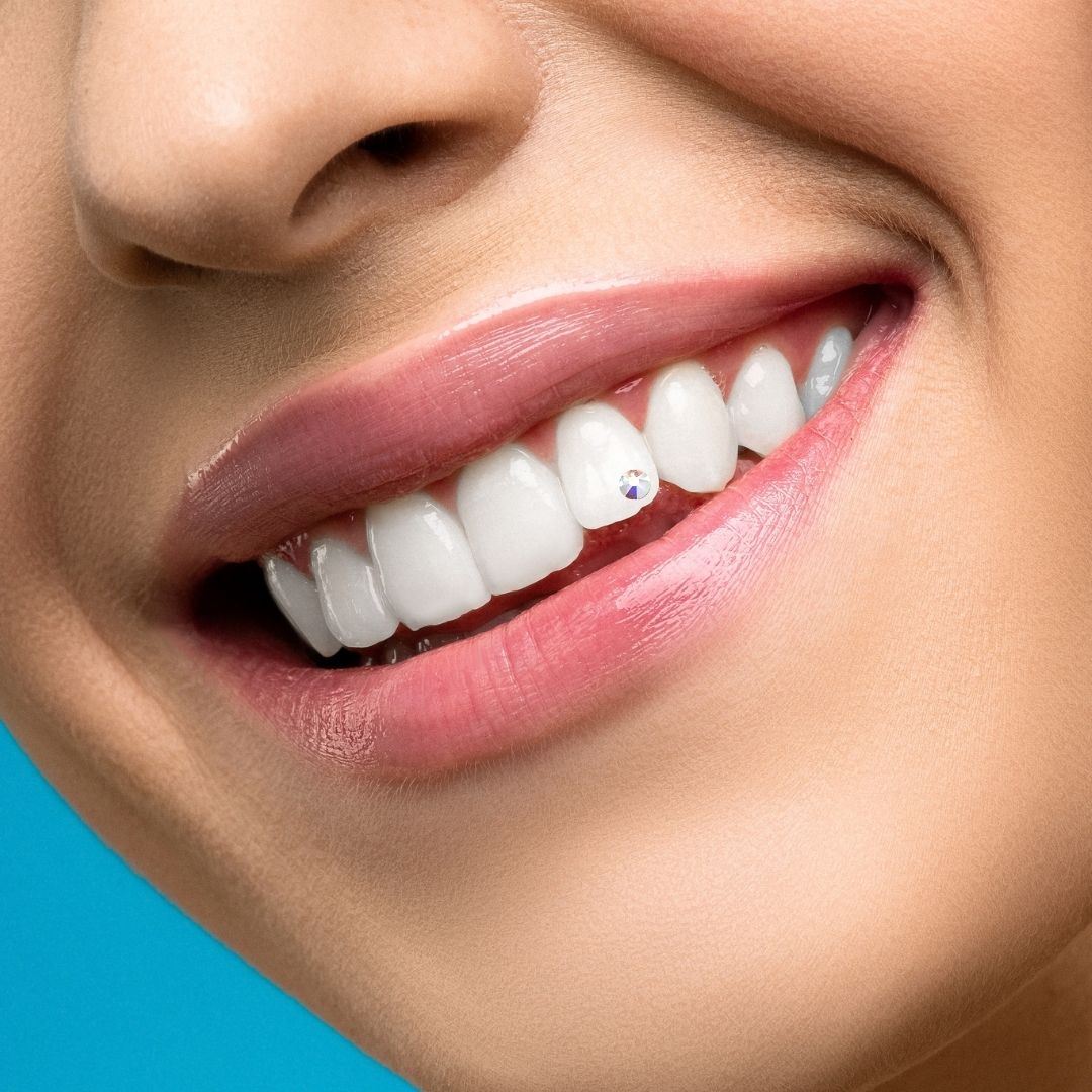 💎 tooth gems 💎 - Swarovski - Peninsula Whitening Clinic