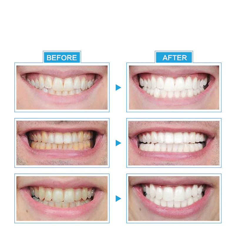 Teeth-Whitening-Mini-LED-Light-3